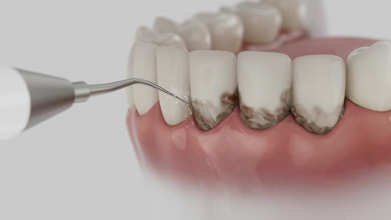 Reliable Dental contractor in Lucas Valley-Marinwood, CA by Dentist Open Now